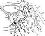 HEPCO BECKER Дуги M 800 intruder 05- (501320 0002)